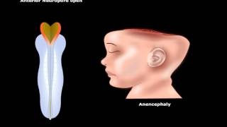 USMLE® Step 1 Neuroscience Development of CNS Animation [upl. by Llednik]