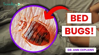 Bedbugs How to Spot and Avoid Them  Doctor Explains [upl. by Aimekahs]