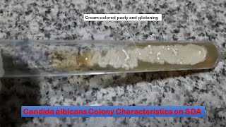 Candida colony characteristics on Sabouraud dextrose agar [upl. by Josie775]