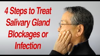 4 Steps to Treat Salivary Gland Swelling at Home [upl. by Cressy]