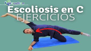 ESCOLIOSIS en quotCquot  EJERCICIOS y RECOMENDACIONES  Fisiolution [upl. by Gnilrac722]