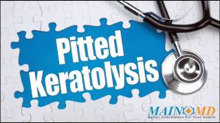 Pitted Keratoylysis ¦ Treatment and Symptoms [upl. by Sidran]