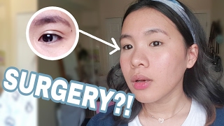 DOUBLE EYELID TAPE REVIEW  TONY MOLY EYELID TAPE [upl. by Dionisio]