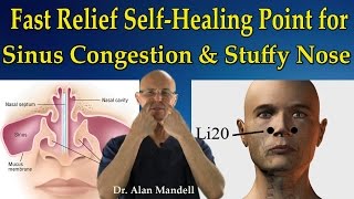 Fast Relief SelfHealing Point for Sinus Congestion Stuffy Nose Headaches  Dr Mandell [upl. by Oettam]