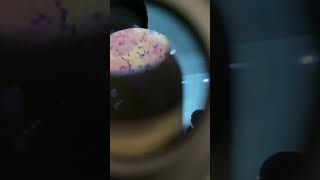 Microscope slide semen [upl. by Eidlog]