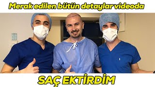 vLog Saç ektirdim  Bütün detaylarıyla saç ekimi nasıl yapılır bu videoda [upl. by Ogden]