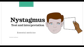 Nystagmus  test and interpretation Essential medicine [upl. by Walsh78]