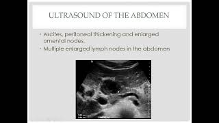 Radiologic features of mesenteric and omental pathologies [upl. by Mckee]