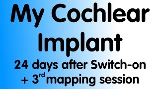 My Cochlear Implant  24 days post switch on including 3rd mapping session [upl. by Notelrahc]