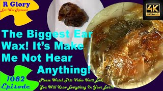 90mm The Biggest Ear Wax🤷‍♂️Its Make Me Not Hear Everything🤦‍♀️New Video Ear Wax Removal 1082 [upl. by Dael]