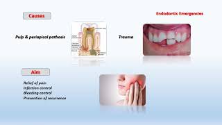 Fall 2020  Endodontic 3  Lec 5  Endodontic emergencies [upl. by Anitniuq]