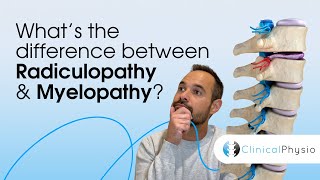 What’s the difference between Radiculopathy and Myelopathy  Expert Physio Guide [upl. by Ahsenyl167]