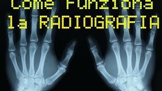 Come funziona la RADIOGRAFIA [upl. by Mou]