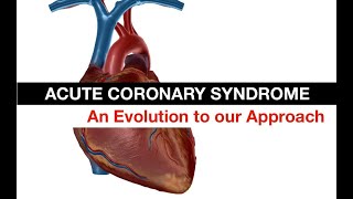 Evolving our Approach to Acute Coronary Syndrome ECGs OMINOMI [upl. by Royd704]