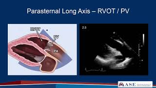 Part 2 Comprehensive TTE in Adults Webinar [upl. by Eiramlehcar801]