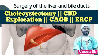 cholecystectomy  cbd exploration  cagb  ERCP  gastro surgery  medical  hospital [upl. by Alair]