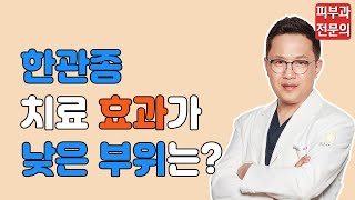 한관종치료 효과가 낮은 부위는  목동고운세상 [upl. by Clarkin956]