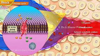 1 Shock  Definition Pathophysiology Vicious cycle Ischemia Reperfusion Syndrome [upl. by Yttik]