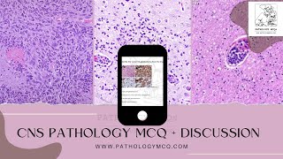 CNS Pathology MCQs  Discussion [upl. by Michale]