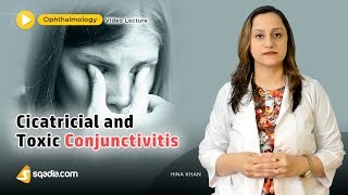 Cicatricial and Toxic Conjunctivitis  Ophthalmology Lecture  Medical VLearning [upl. by Jerald287]