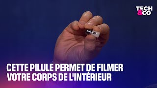 Cette pilule permet de filmer votre corps de l’intérieur [upl. by Ennaylloh]