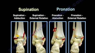 Ankle Fractures Lauge Hansen Introduction  Everything You Need To Know  Dr Nabil Ebraheim [upl. by Derfniw254]