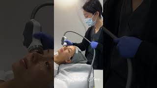 Inmode Lumecca IPL treatment at Revive Aesthetic Clinic [upl. by Zenas]