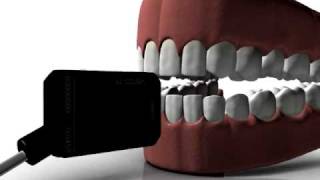 Dental Sensor  Owandy Visteo new concept in Digital Radiography [upl. by Nnainot872]