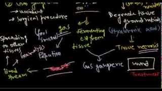 Clostridium perfringens infection and pathogenesis [upl. by Esemaj]