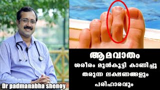 ഈ ലക്ഷണം നിങ്ങൾക്കുണ്ടോ ശ്രദ്ധിക്കുക Dr Padmanabha shenoy RheumatismBaijus Vlogs [upl. by Kelwen]