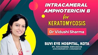 Intracameral Amphotericin B for Keratomycosis Dr Suresh K Pandey Suvi Eye Kota Indiampg [upl. by Yenduhc642]