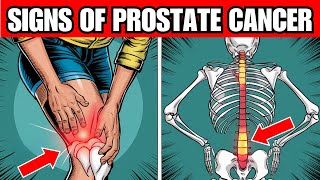 8 Warning Signs of PROSTRATE CANCER You Cant Ignore [upl. by Agueda]