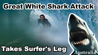 Shark Attack Takes Surfers Leg Kai McKenzie Australian Shark Attacks [upl. by Cass]