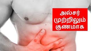 Stomach Ulcer Symptoms and Treatment at Home  Stomach Ulcer Home Remedy Tamil [upl. by Dorkus]