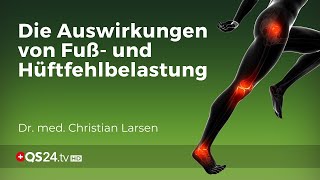 Knieprobleme vermeiden Die Bedeutung von Fuß und Hüftausrichtung  Dr Christian Larsen  QS24 [upl. by Eahc]