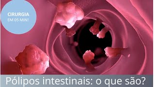 Pólipos intestinais o que são como diagnosticar e tratar  Fernando Eyer [upl. by Nahtannhoj]