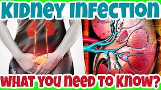 What You NEED to KNOW about KIDNEY INFECTION A Serious UTI Condition  Pyelonephritis [upl. by Saxet681]