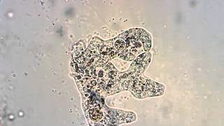 Amoeba from a pond in Oregon feeding and division [upl. by Garret317]