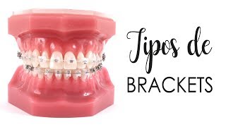 CONOCE LOS TIPOS DE BRACKETS  ¿CUÁLES SON MEJORES [upl. by Yhtak]