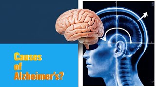 Whats REALLY Causing ALZHEIMERS Disease [upl. by Magdala921]