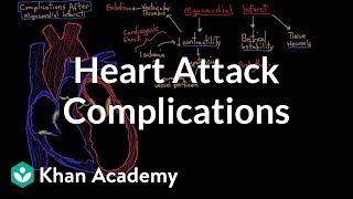 Complications after a heart attack myocardial infarction  NCLEXRN  Khan Academy [upl. by Eenram]