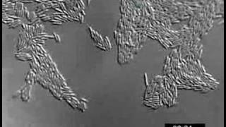 Pseudomonas aeruginosa twitching motility YFPPilU [upl. by Amzu]