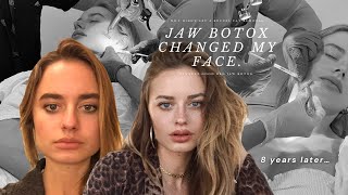 The truth on how I changed my face shape 🎀 ✨JAW BOTOX ✨🎀 [upl. by Llehcam]