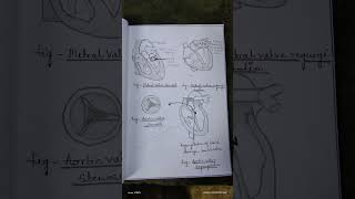 Assignment on valvular heart disease MSNIIgnm2ndyear bscnursing assignment notes study [upl. by Lashonda]