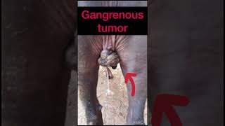 Gangrenous tumor l dr Umar khan [upl. by Ellennad508]