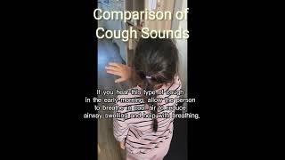 If you hear this kind of cough sound first have them breathe in cold airㅣCroup cough sound [upl. by Santiago]