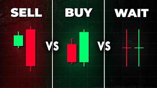 The BEST Candlestick Pattern Guide Youll EVER FIND [upl. by Llertnad]