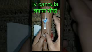 Iv cannulation techniquemotivation nursingviralvideo shorts [upl. by Adyol]