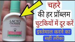 Lacto Calamine Face Lotion Skin Benefitsहिन्दी मैं Calamine lotion Remove Acne Pimples Dark spots [upl. by Cathrine]