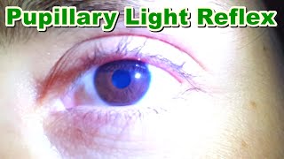 Pupillary Light Reflex  Contraction of Pupil MiosisMyosis  Function  Brain Stem [upl. by Standford]